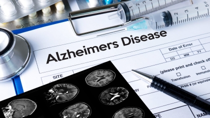 COVID & Alzheimers-document