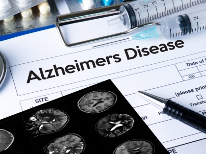 COVID & Alzheimers-document